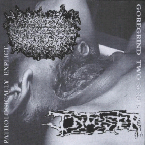 Infester (USA-2) : Syphillis de Genitales - Infester